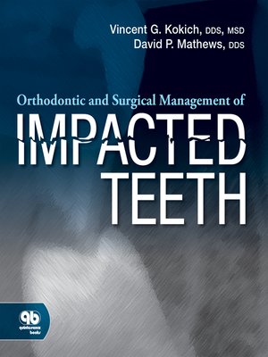 cover image of Orthodontic and Surgical Management of Impacted Teeth